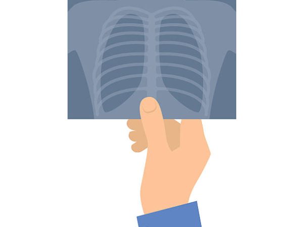 Human hand holding x-ray image. Medicine and healthcare flat concept illustration. Hand, lung radiography. Vector design element for medical, anatomy, surgery, and xray infographic.
